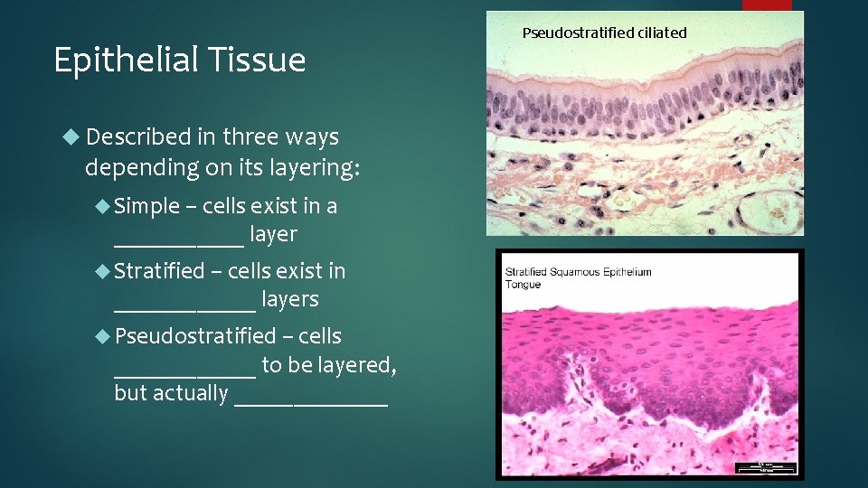 Epithelial Tissue Described in three ways depending on its layering: Simple – cells exist