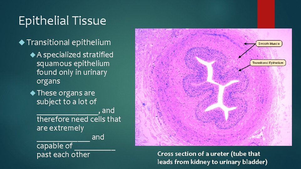 Epithelial Tissue Transitional epithelium A specialized stratified squamous epithelium found only in urinary organs