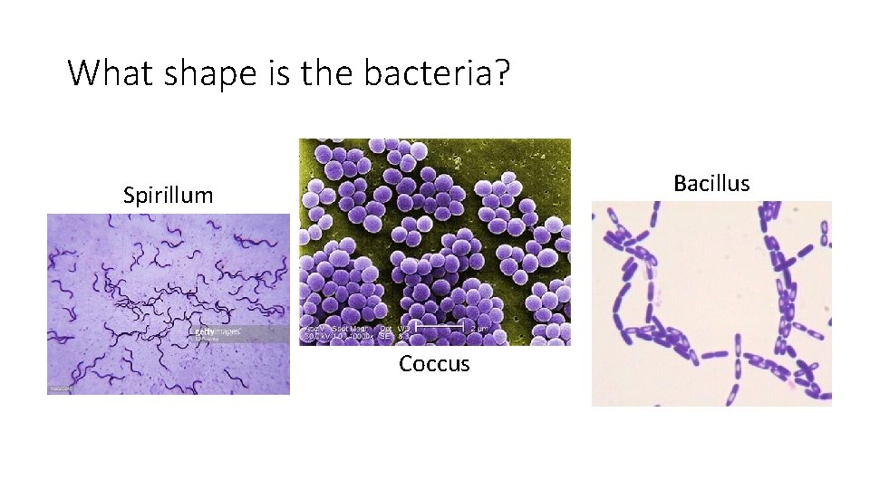 What shape is the bacteria? Bacillus Spirillum Coccus 