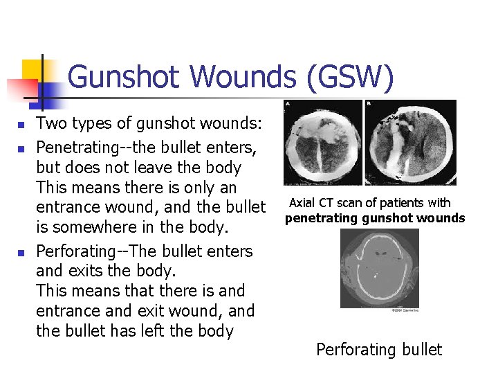 Gunshot Wounds (GSW) n n n Two types of gunshot wounds: Penetrating--the bullet enters,