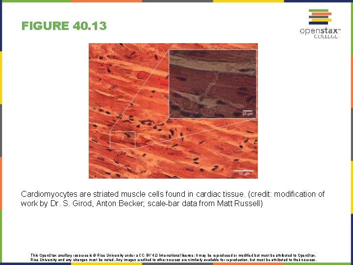 FIGURE 40. 13 Cardiomyocytes are striated muscle cells found in cardiac tissue. (credit: modification