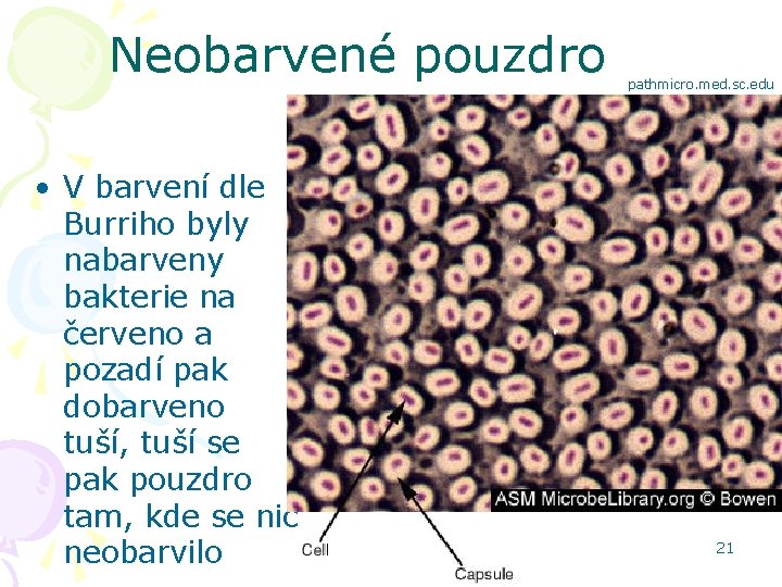 Neobarvené pouzdro • V barvení dle Burriho byly nabarveny bakterie na červeno a pozadí