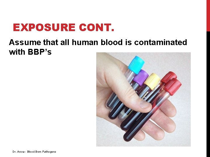 EXPOSURE CONT. Assume that all human blood is contaminated with BBP’s Dr. Arora -