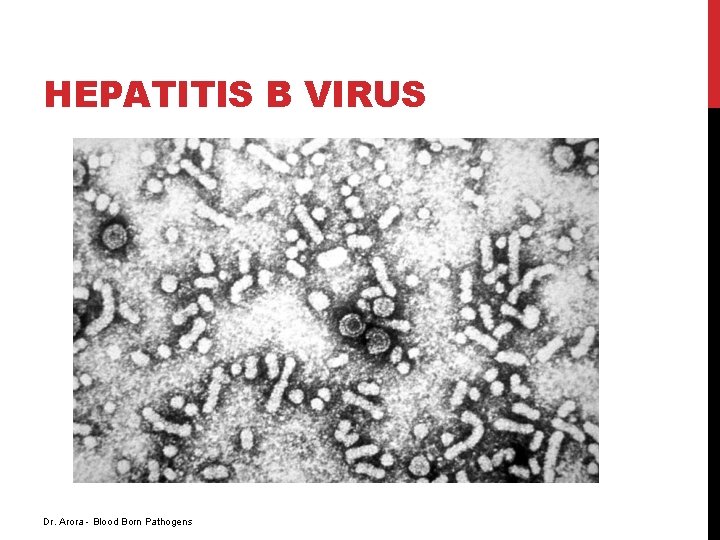 HEPATITIS B VIRUS Dr. Arora - Blood Born Pathogens 