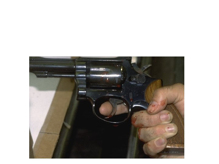 With a contact or very close range gunshot wound, it is possible to have With a contact or very close range gunshot wound, it is possible to have