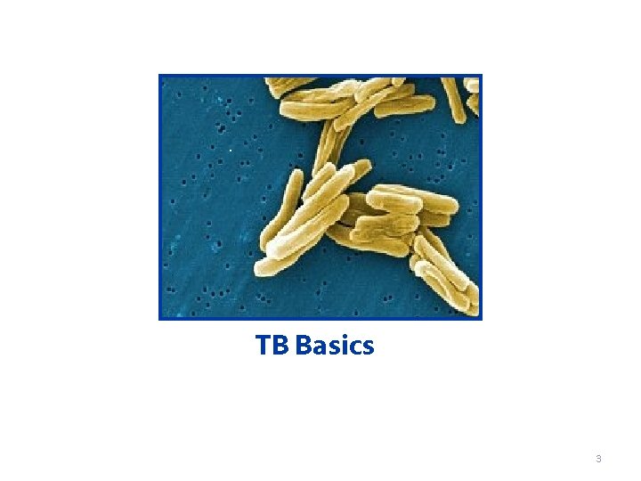 TB Basics 3 