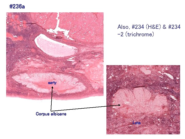 #236 a Also, #234 (H&E) & #234 -2 (trichrome) early Corpus albicans Late 