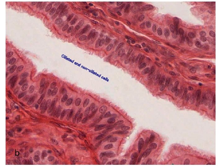 Cil iate da nd non -ci liat ed cel ls 