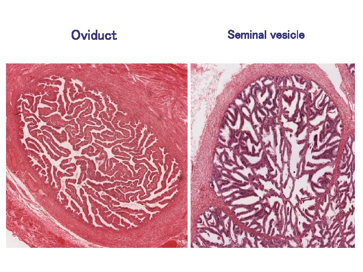 Oviduct Seminal vesicle 