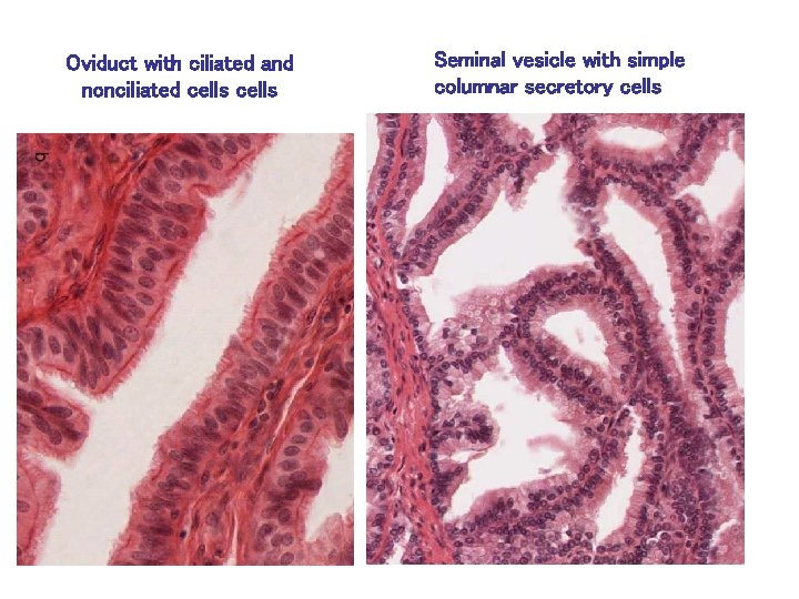 Oviduct with ciliated and nonciliated cells Seminal vesicle with simple columnar secretory cells 