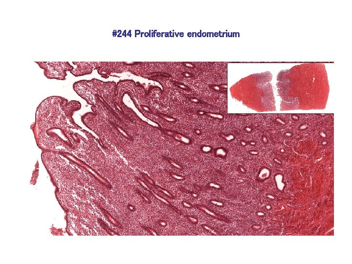 #244 Proliferative endometrium 