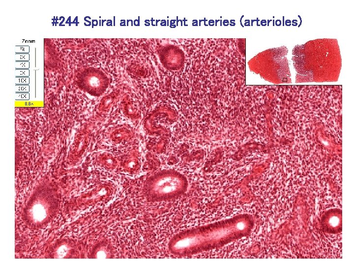 #244 Spiral and straight arteries (arterioles) 