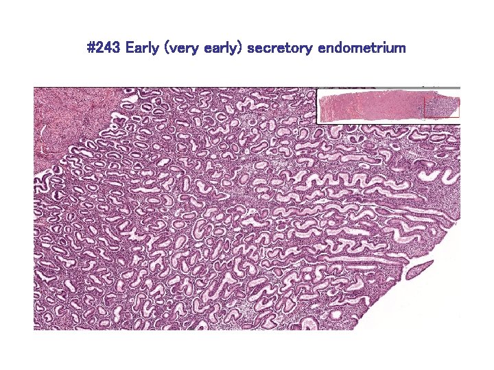 #243 Early (very early) secretory endometrium 