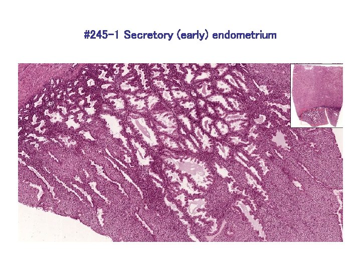 #245 -1 Secretory (early) endometrium 