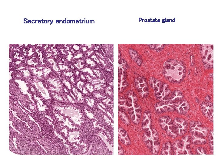 Secretory endometrium Prostate gland 