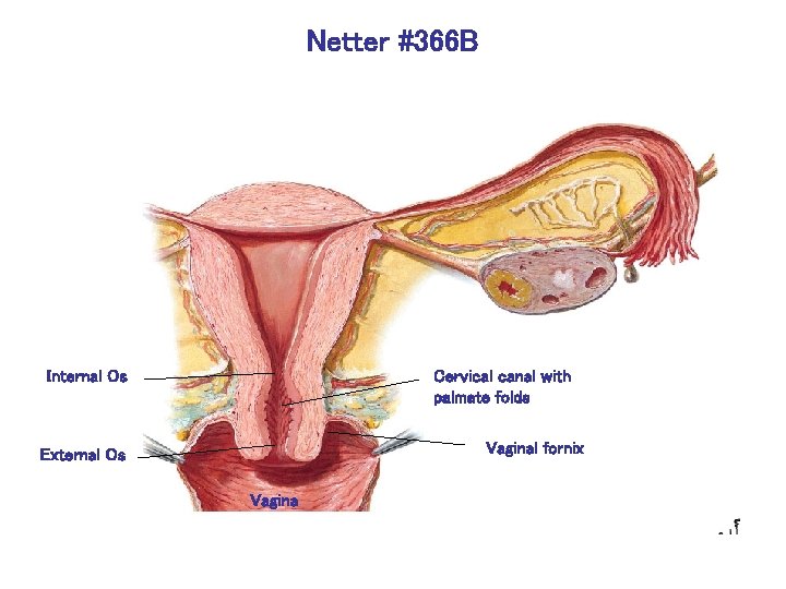 Netter #366 B Internal Os Cervical canal with palmate folds Vaginal fornix External Os