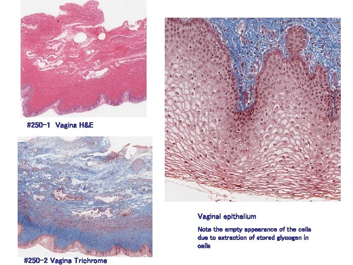 #250 -1 Vagina H&E Vaginal epithelium Note the empty appearance of the cells due