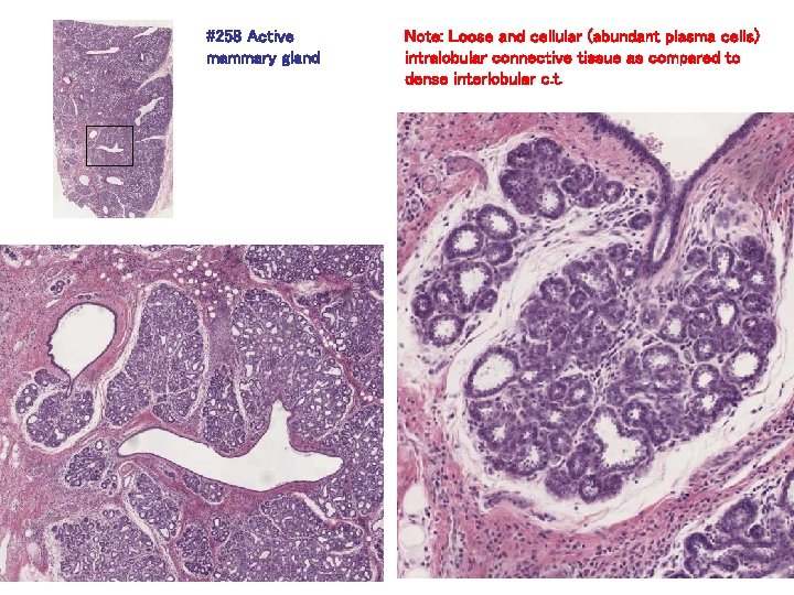 #258 Active mammary gland Note: Loose and cellular (abundant plasma cells) intralobular connective tissue