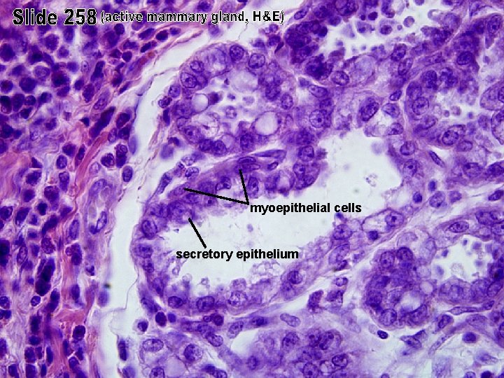 myoepithelial cells secretory epithelium 