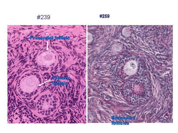 #269 #239 Primordial follicle Primary follicle Secondary follicles 