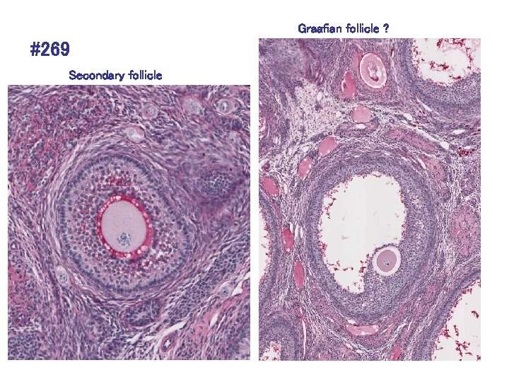 Graafian follicle ? #269 Secondary follicle 
