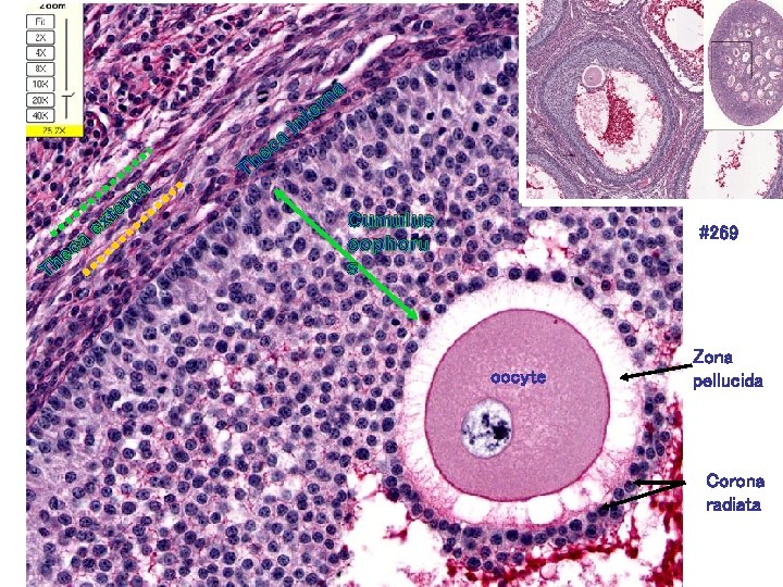 Th a c e t x e n er a T c he a