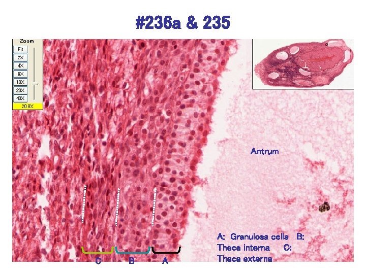 #236 a & 235 Antrum C B A A: Granulosa cells B: Theca interna