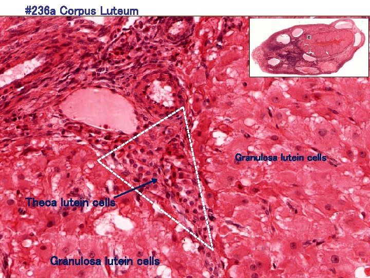#236 a Corpus Luteum Granulosa lutein cells Theca lutein cells Granulosa lutein cells 