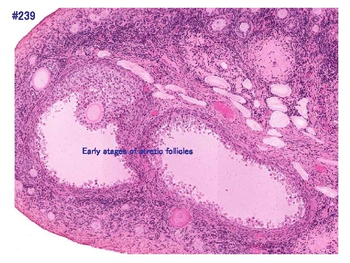 #239 Early stages of atretic follicles 