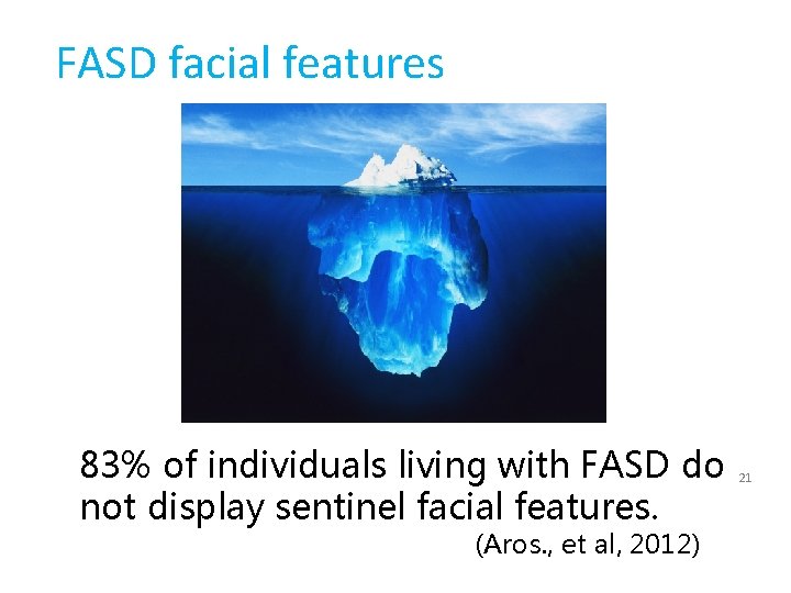 FASD facial features 83% of individuals living with FASD do not display sentinel facial