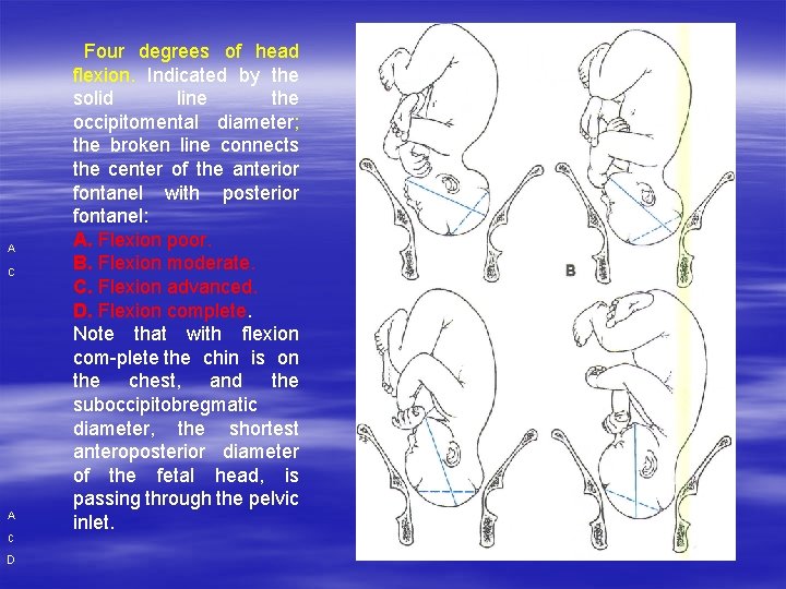 A c D Four degrees of head flexion. Indicated by the solid line the A c D Four degrees of head flexion. Indicated by the solid line the