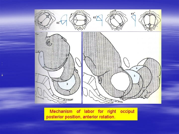 , . , 0 Mechanism of labor for right occiput posterior position, anterior rotation. , . , 0 Mechanism of labor for right occiput posterior position, anterior rotation.