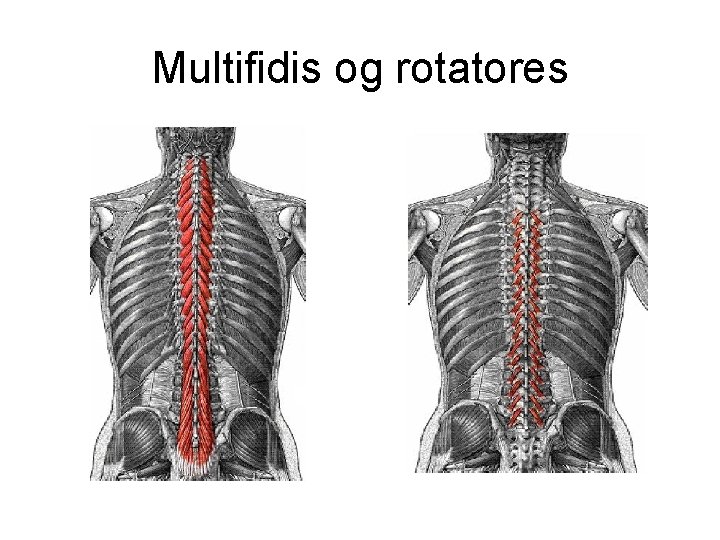 Multifidis og rotatores 