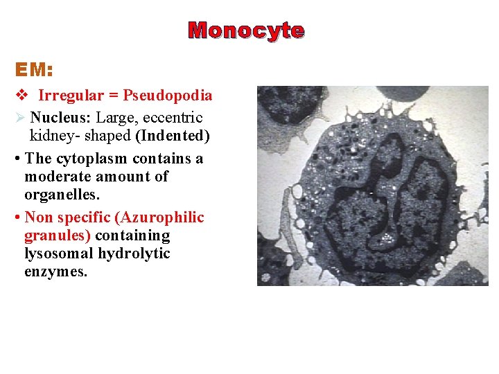 Monocyte EM: v Irregular = Pseudopodia Ø Nucleus: Large, eccentric kidney- shaped (Indented) •