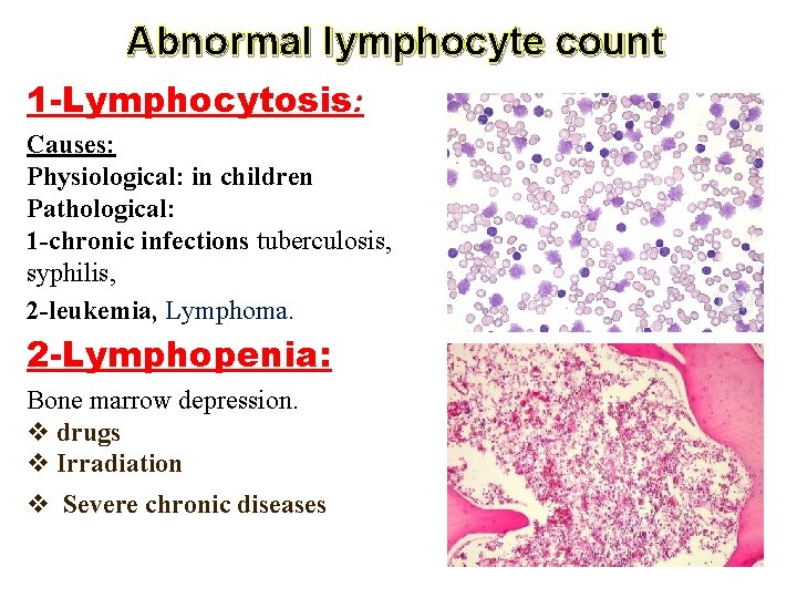 Abnormal lymphocyte count 1 -Lymphocytosis: Causes: Physiological: in children Pathological: 1 -chronic infections tuberculosis,