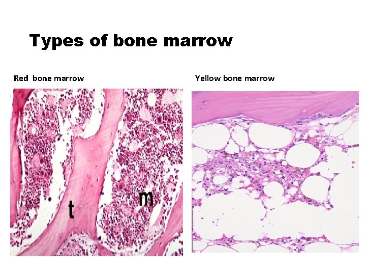 Types of bone marrow Red bone marrow Yellow bone marrow 