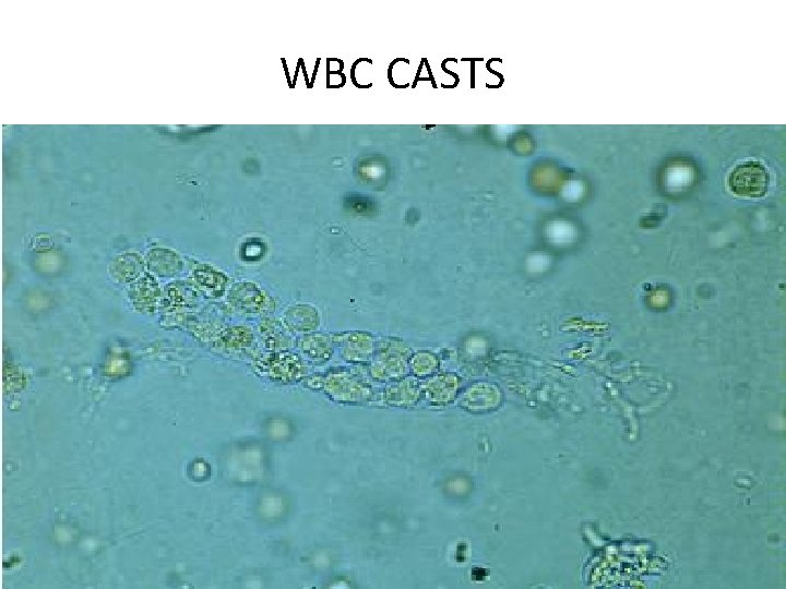 WBC CASTS 