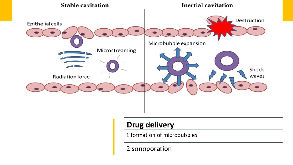 Drug delivery 1. formation of microbubbles 2. sonoporation 