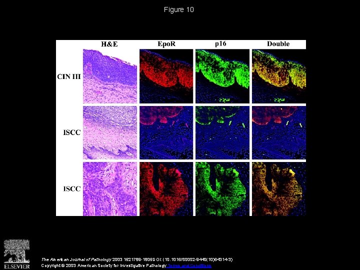 Figure 10 The American Journal of Pathology 2003 1621789 -1806 DOI: (10. 1016/S 0002