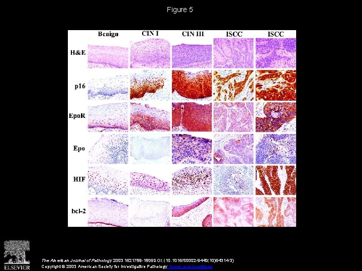 Figure 5 The American Journal of Pathology 2003 1621789 -1806 DOI: (10. 1016/S 0002