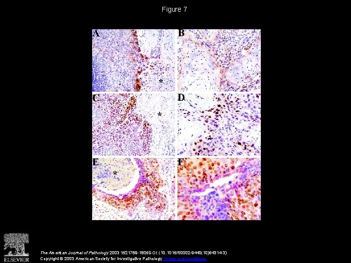 Figure 7 The American Journal of Pathology 2003 1621789 -1806 DOI: (10. 1016/S 0002