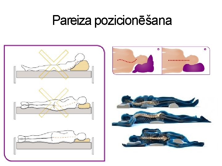 Pareiza pozicionēšana 