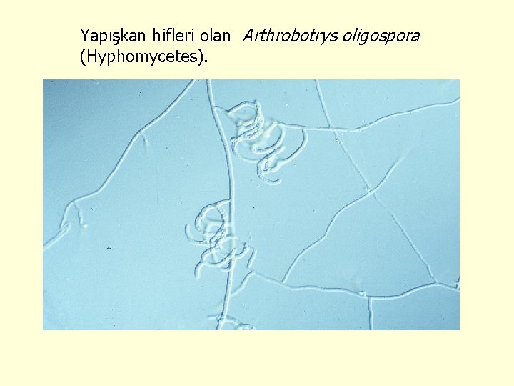 Yapışkan hifleri olan Arthrobotrys oligospora (Hyphomycetes). 