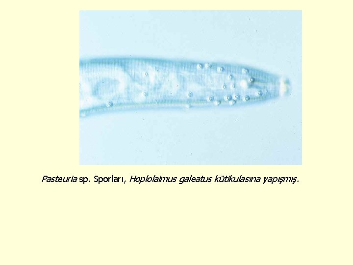 Pasteuria sp. Sporları, Hoplolaimus galeatus kütikulasına yapışmış. 
