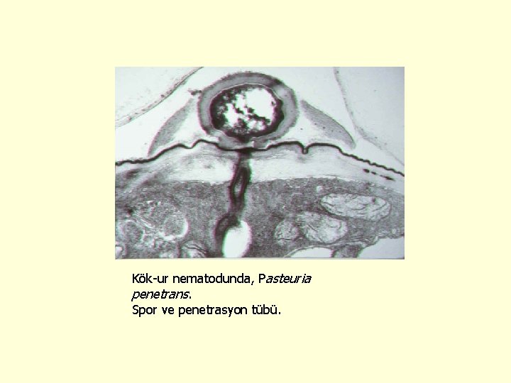 Kök-ur nematodunda, Pasteuria penetrans. Spor ve penetrasyon tübü. 