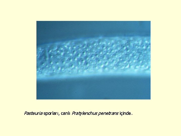 Pasteuria sporları, canlı Pratylenchus penetrans içinde. 