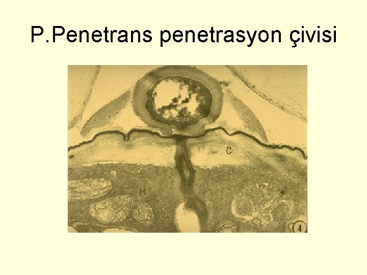 P. Penetrans penetrasyon çivisi 