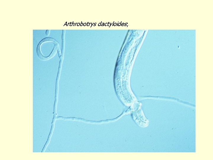 Arthrobotrys dactyloides; 