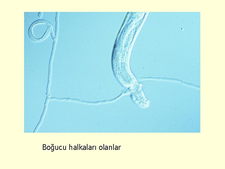 4 Constricting ring Boğucu halkaları olanlar 