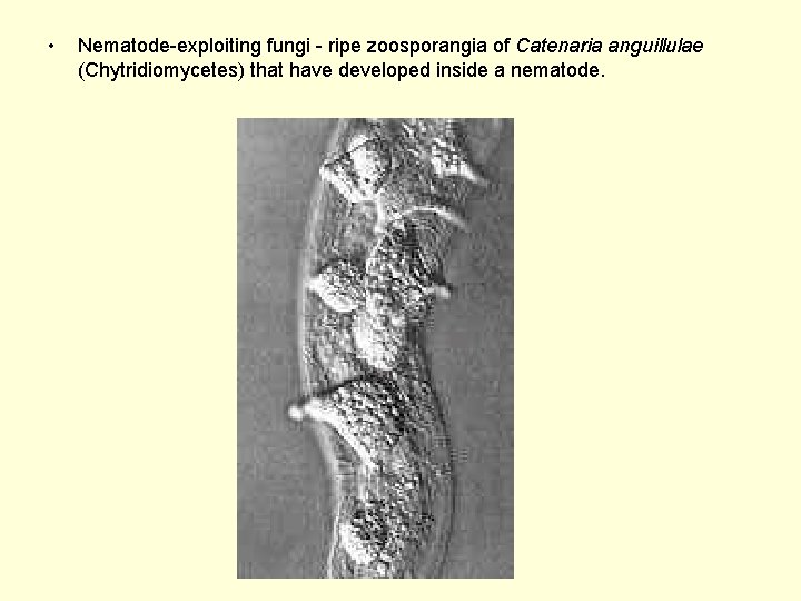  • Nematode-exploiting fungi - ripe zoosporangia of Catenaria anguillulae (Chytridiomycetes) that have developed